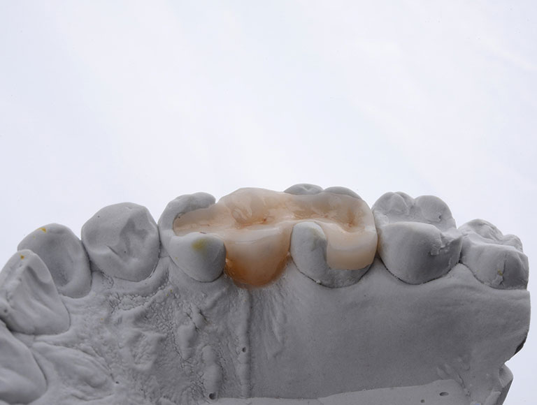 precisionj restoration